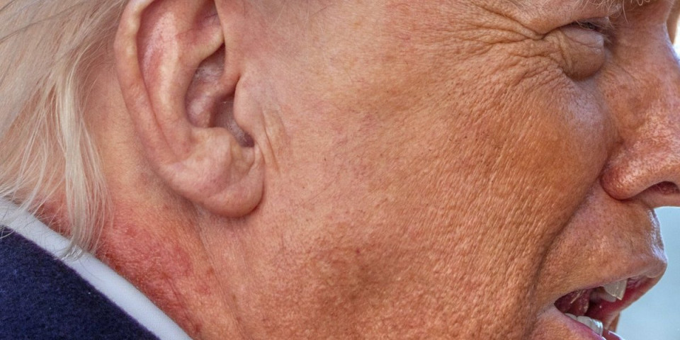 (FOTO) Šta se ovo dešava sa Trampom?! Odjeknulo ozbiljno pitanje o zdravlju vrhovnog komandanta SAD