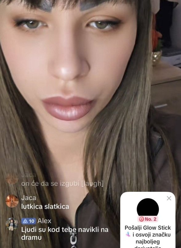 Prve slike Miljane Kulić sa lečenja: Evo kako izgleda 2 meseca nakon izbacivanja iz Elite 9