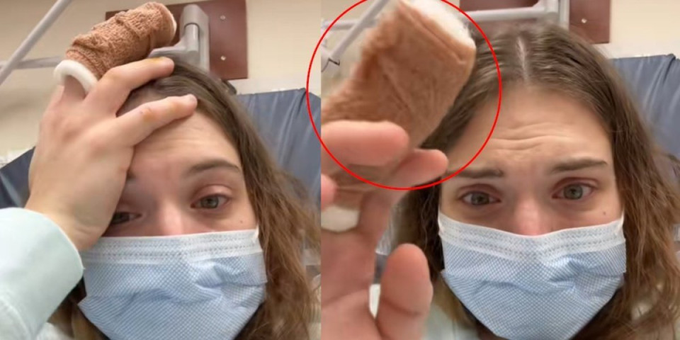 Grickala nokte, pa doživela horor: Umalo ostala bez prsta - šok ispovest zapalila internet (VIDEO)