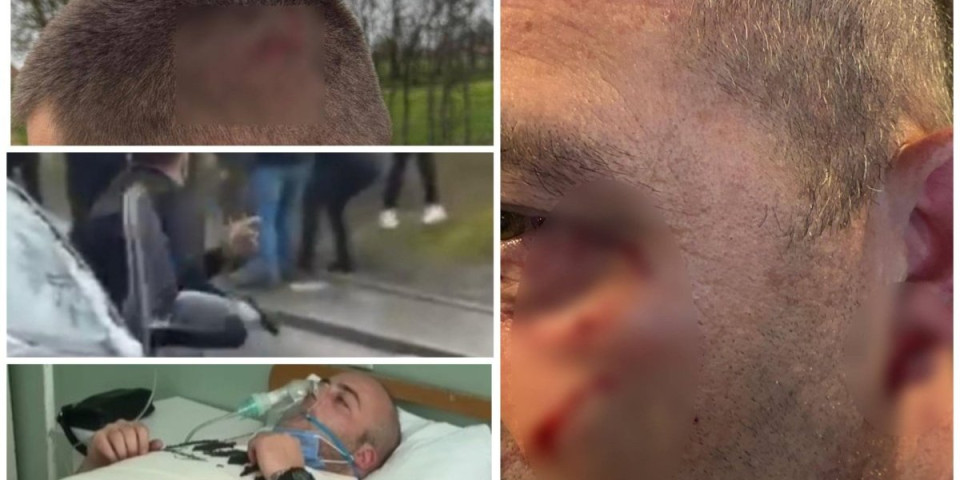 Batinaška politika blokadera! Napadaju žene, biju, potežu pištolje: Pala krv u Bajinoj bašti, Smederevskoj Palanci... (FOTO/VIDEO)