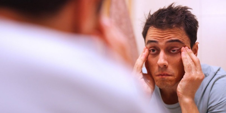 Budite sa krmeljivim očima? Ovo su uzroci nastanka i kada se obratiti lekaru