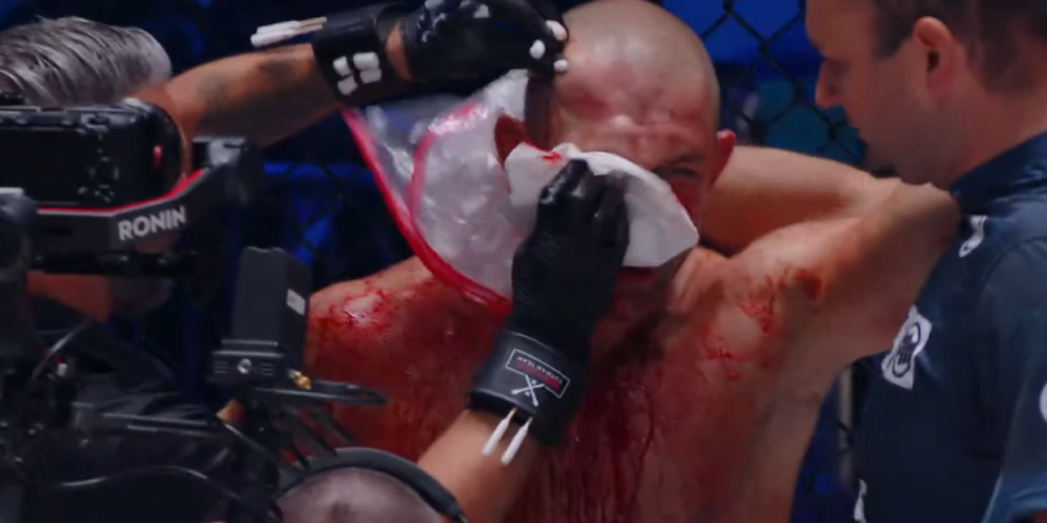 Brutalno! Srbin demolirao Slovenca usred Ljubljane (VIDEO)