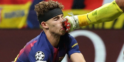 Uznemirujuće: Fermin dobio kopačku u glavu, udarac koji je zaprepastio Evropu (FOTO)