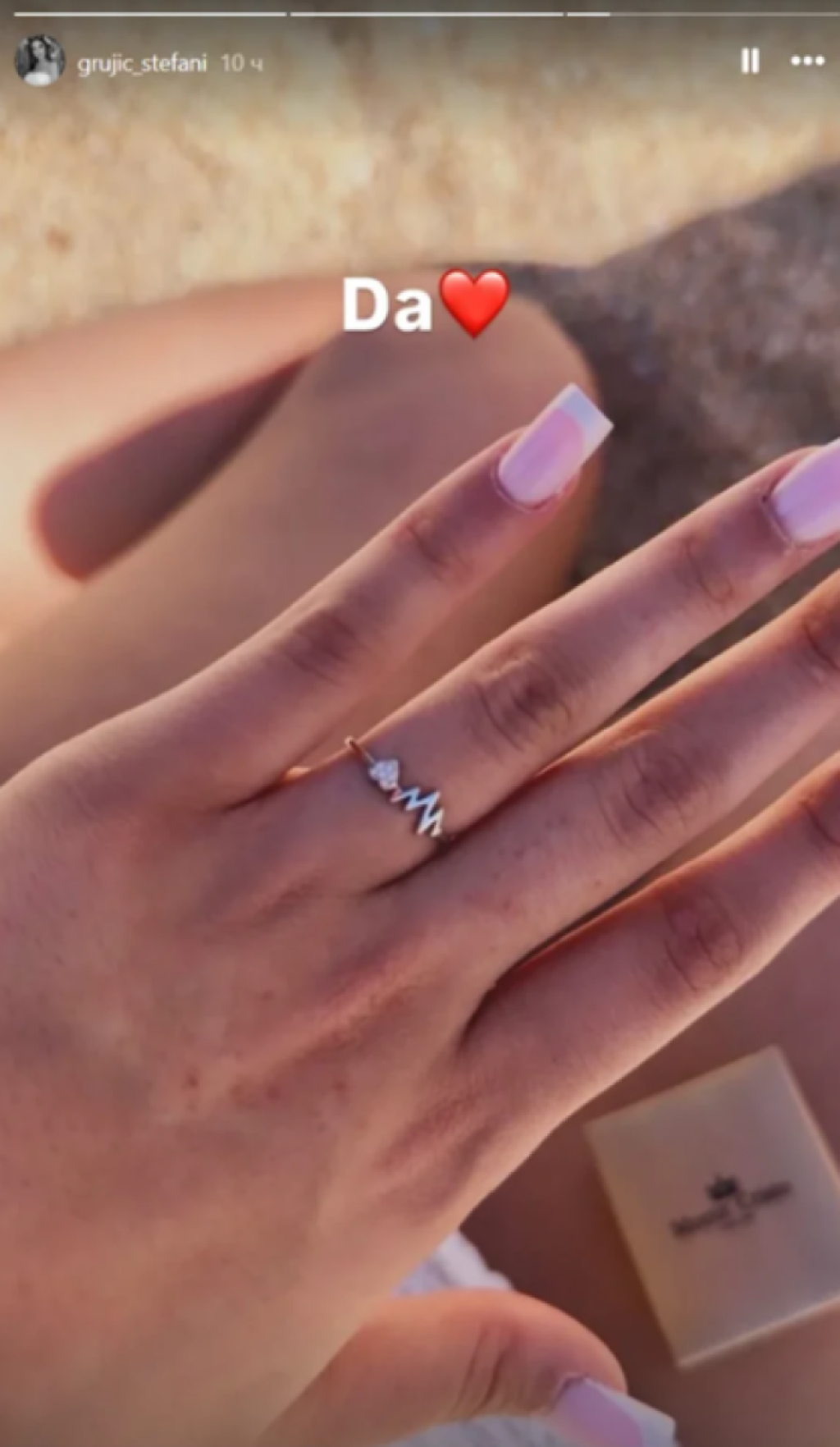 Bila u vezi sa ženom, a sada se verila: Bivša zadrugarka se pohvalila prstenom (FOTO)