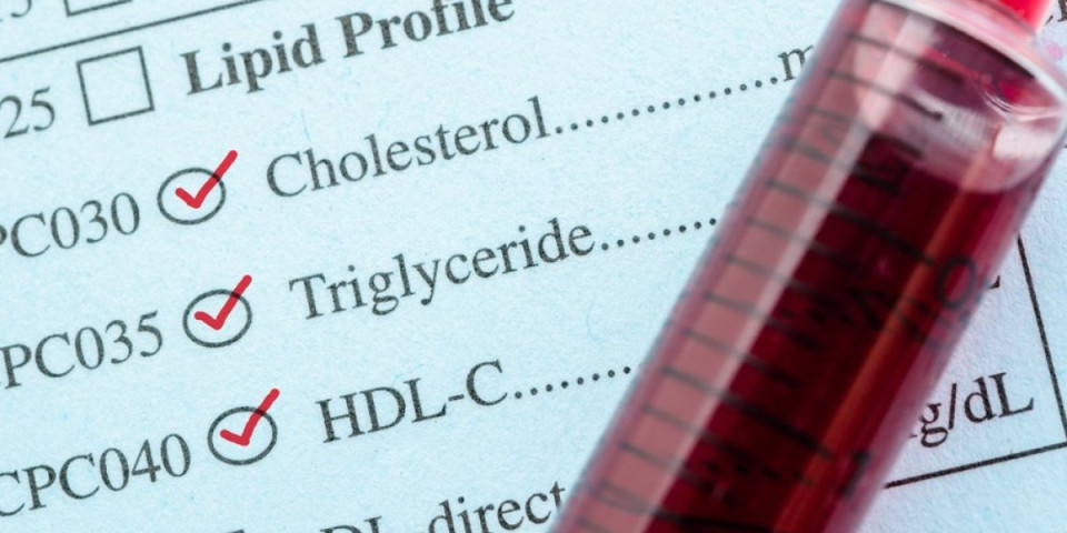 Rešite visoke trigliceride bez lekova: Kombinacija koja provereno radi - bićete iznenađeni rezultatima