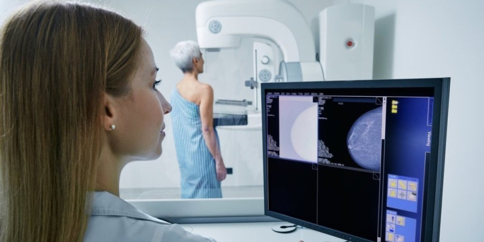 Kada je vreme za prvu mamografiju? Doktori otkrivaju gde mnoge žene greše