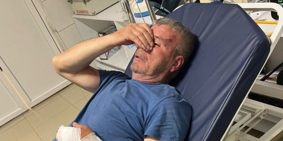 Zastrašujuće! Albanac pretukao Srbina sa KiM dok je štito dete - dokle ide teror Kurtijev sledbenika?! (FOTO)