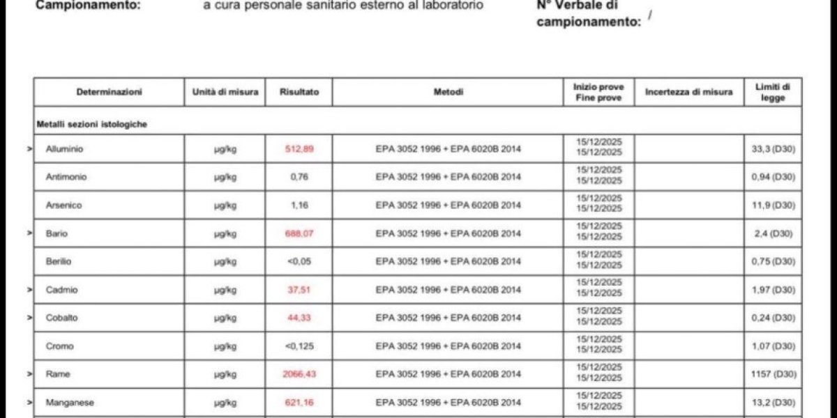 Analize kojima je utvrđeno prisustvo osiromašenog uranijuma u organizmu
