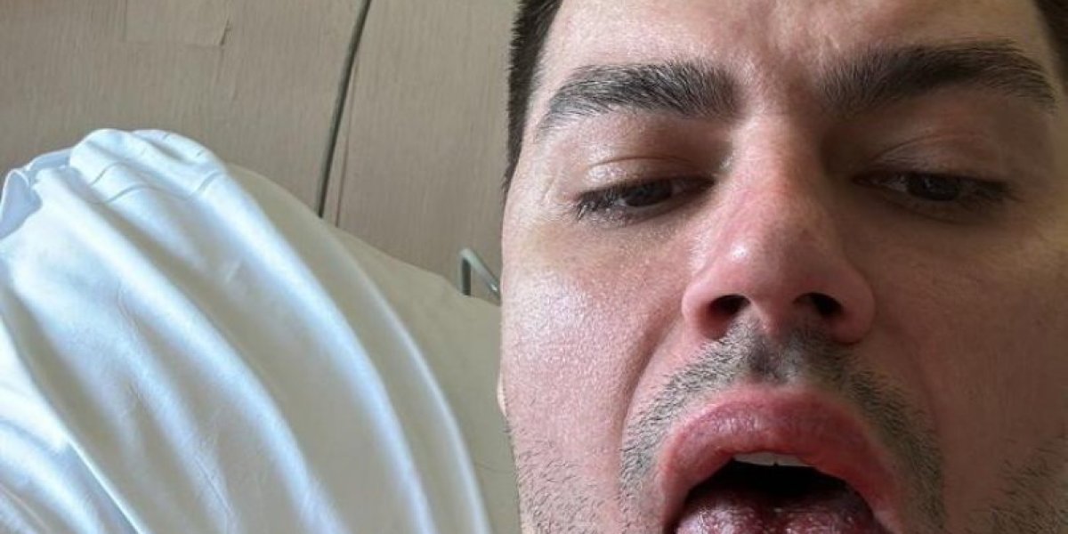 Sredstvo za profesionalne mašine za pranje sudova Aleksandru spržilo organe.