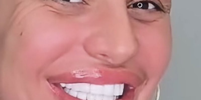 "I ona je ovo platila?" Sanjine nove zube porede sa pločicama u kupatilu - Komentari Srba bole više od zubarske bušilice!