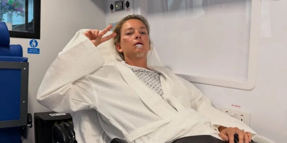 Poznatoj teniserki unakaženo lice: Krenula na Vimbldon, pa polomila bradu i zube