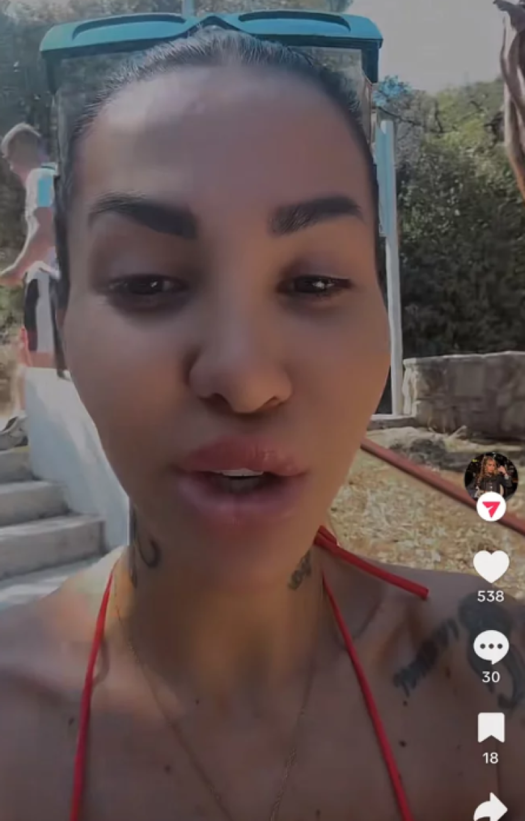 Aneli Ahmić otišla na remont posle Elite! Evo šta je sve radila i kako sada izgleda (FOTO)