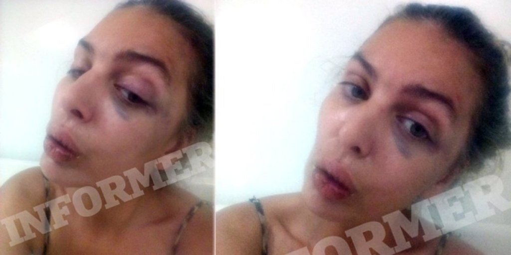 Drama u konzulatu Hrvatske u Beogradu! Starleta upala i moli za pomoć