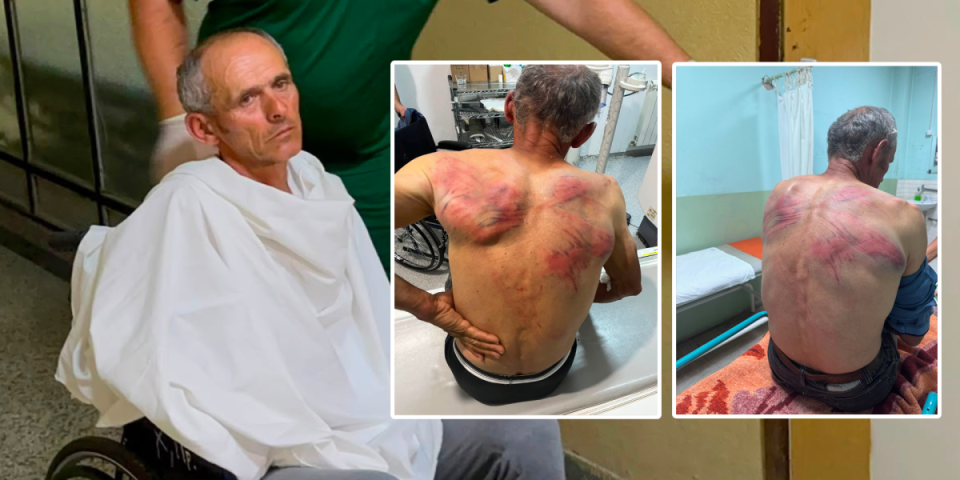 (UZNEMIRUJUĆE FOTOGRAFIJE) Kurtijeve zveri brutalno pretukle Srbina! Jezivo iživljavanje u Zubinom Potoku: Vezali ga za drvo, tukli ga crevom za vodu