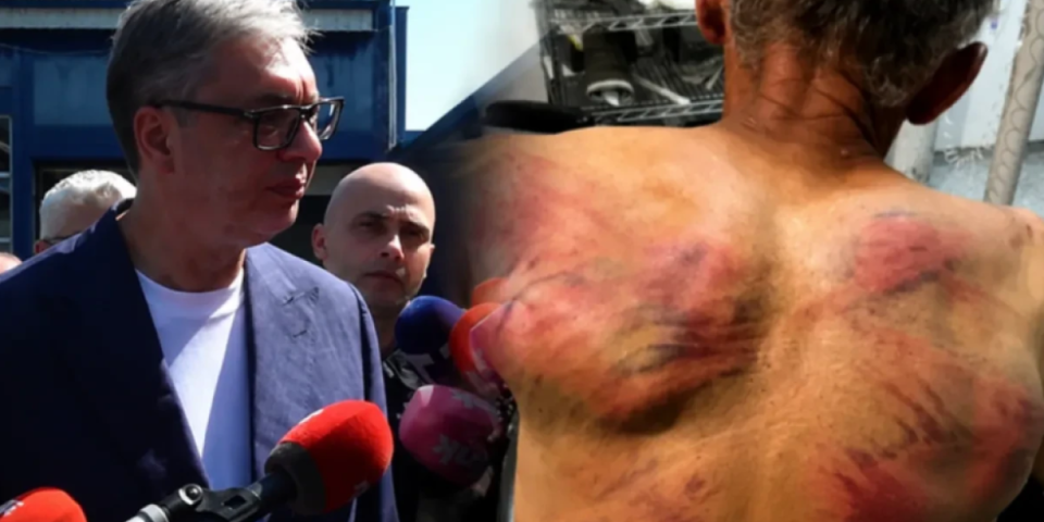 "Njegova polomljena leđa su lice Aljbina Kurtija!" Vučić o stradanju Srbina iz Zubinog Potoka: Muški podnosi paklene bolove, ali ovo im neće proći (FOTO)