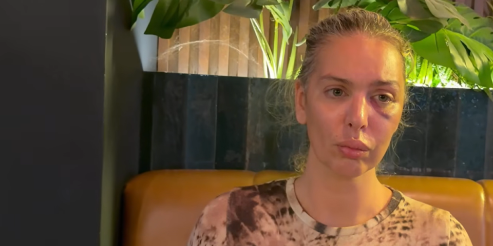 Prošla sito i rešeto! Ava Karabatić nikad emotivnija - Podelila šokirala priznanjem: "Nemam ni gram snage da se podignem"