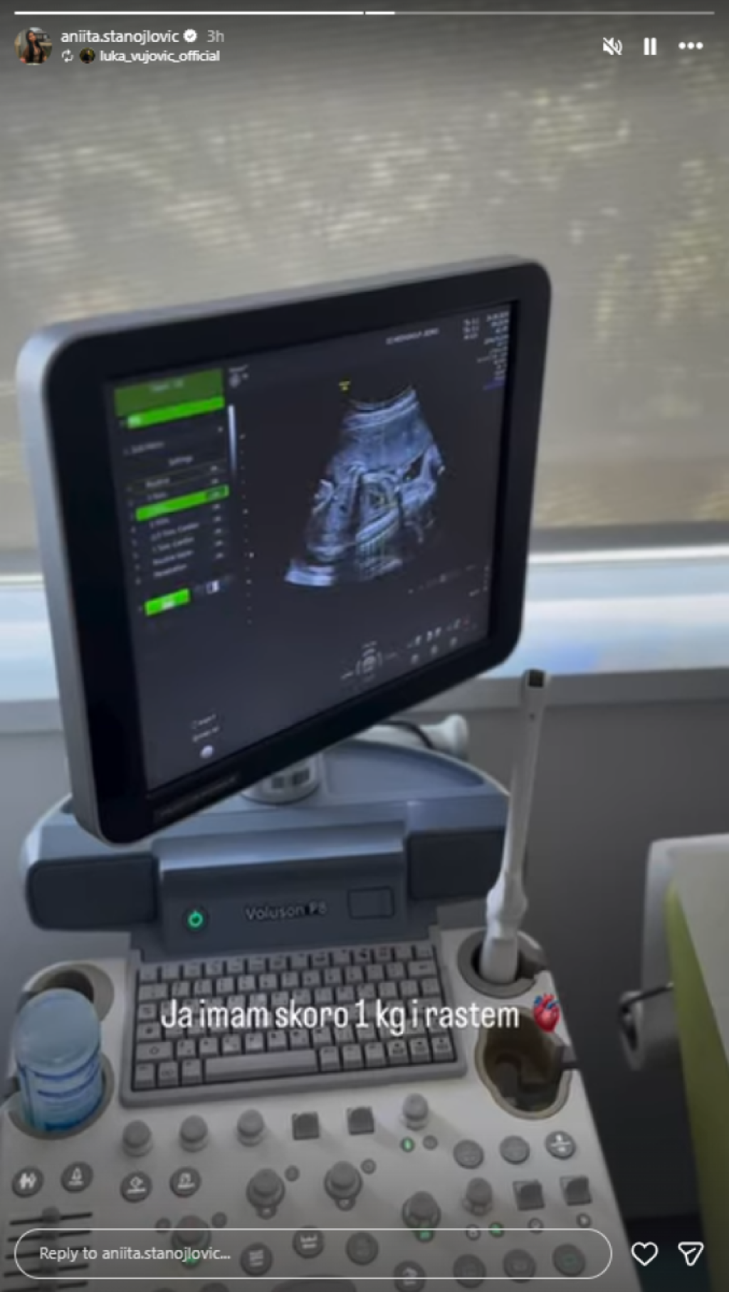 Trudna Anita kod lekara! Zbog onoga što je čula u ordinaciji rijaliti učesnica u suzama