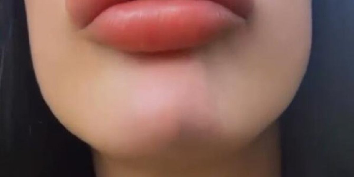 Sofija Lips