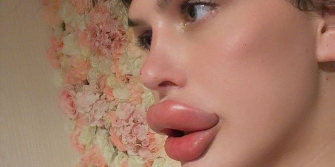 Sofija Lips