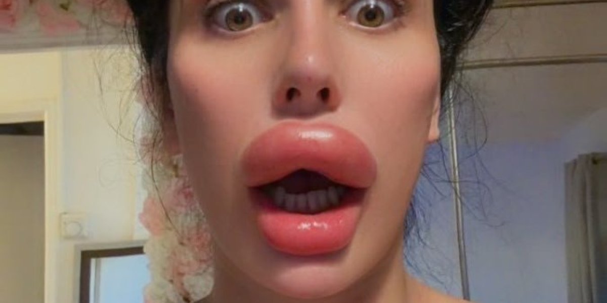 Sofija Lips
