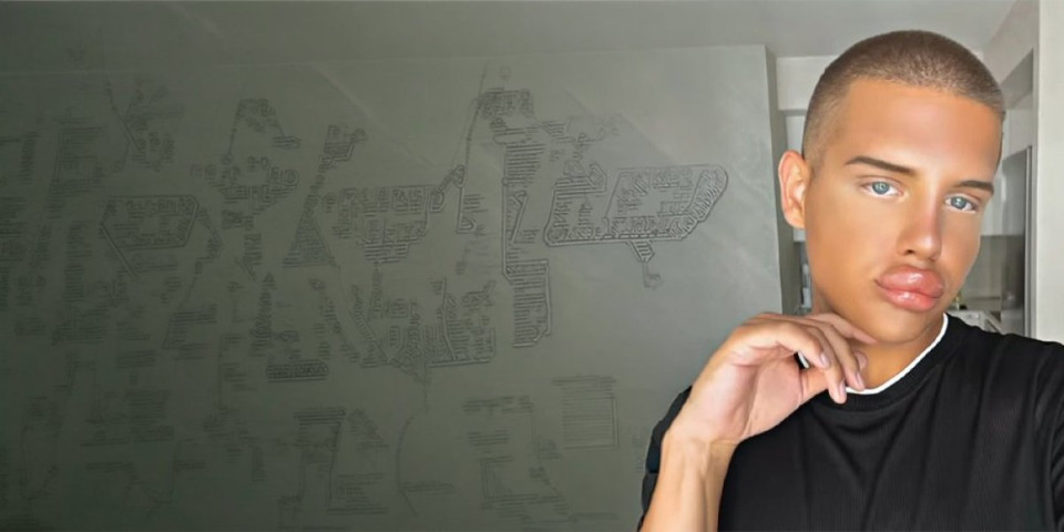 Šta je, bre, ovo? Zdravstveni radnik (19) napumpan do daske, zbog ovih usana se svima okreće želudac! (FOTO)