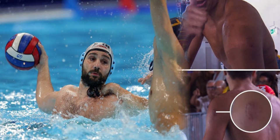 Ozbiljan skandal u finalu vaterpola! Ujeo igrača u sred igre za ruku i leđa
