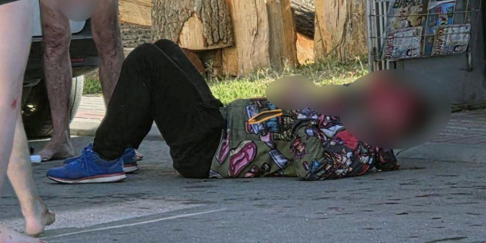 Bejzbolka mu smrskala lice, krv lipti, ne staje! Ovako izgleda prebijeni Čačanin, a evo i ko ga je unakazio! (FOTO)