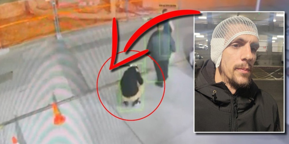 Oštećen mu je sluh! Snimatelj Informera se uključio u program - Nakon napada je i dalje u stanju šoka (VIDEO)